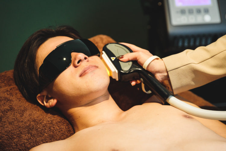 ヒゲ脱毛の施術の様子